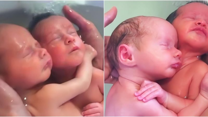 Eternal Connection: Twin Babies Embrace from Birth, Leaving Medical Professionals in Awe of Their Enchanting Bond