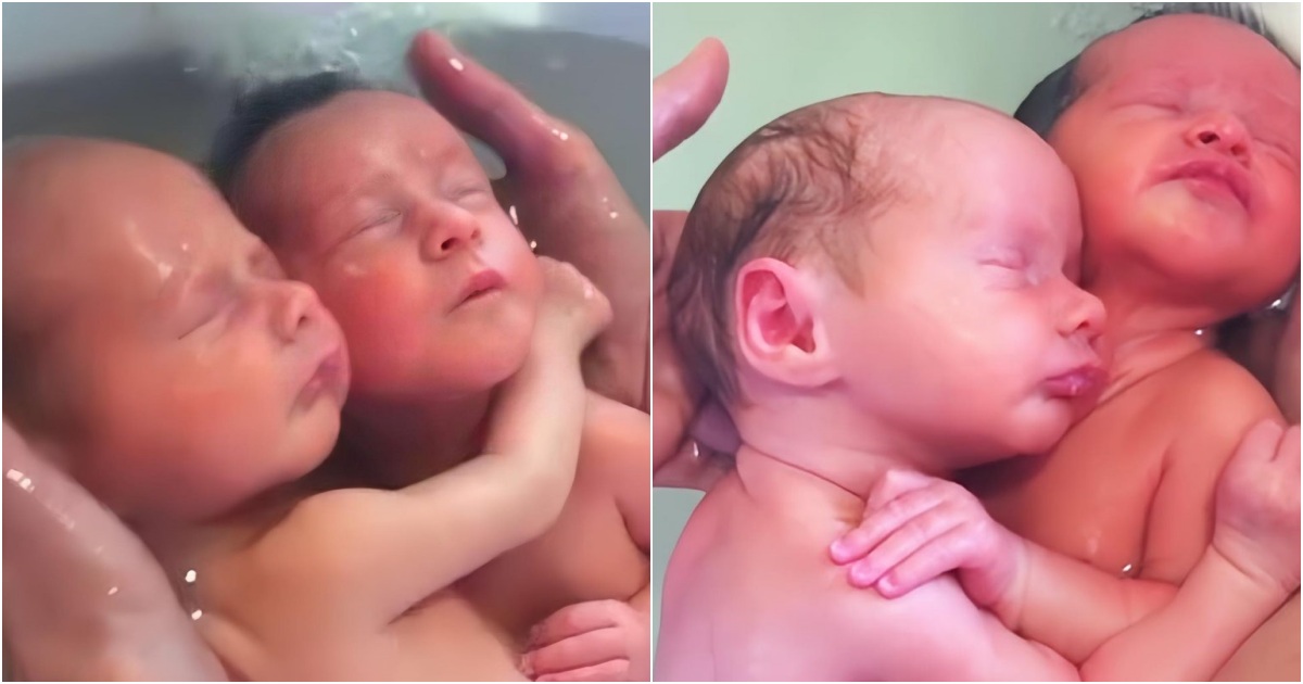 Eternal Connection: Twin Babies Embrace from Birth, Leaving Medical Professionals in Awe of Their Enchanting Bond