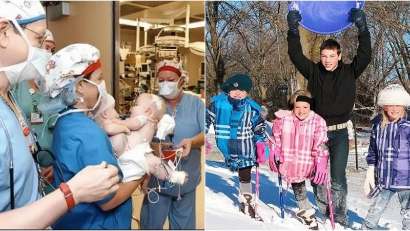 Two siamese triplets who faced significant challenges fourteen years ago have been photographed.