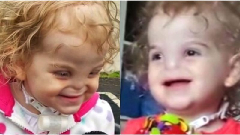 Turning the Impossible into a Touch: The Incredible Journey of Tessa Evans, Born Without a Nose