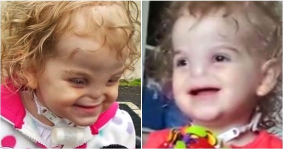 Turning the Impossible into a Touch: The Incredible Journey of Tessa Evans, Born Without a Nose