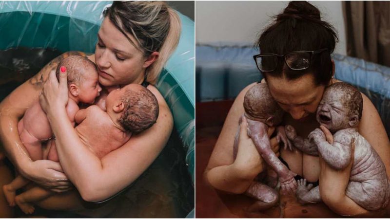 A Special Connection Twins Born after 9 months in the womb