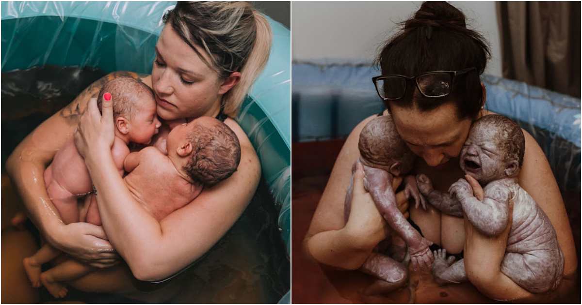 A Special Connection Twins Born after 9 months in the womb