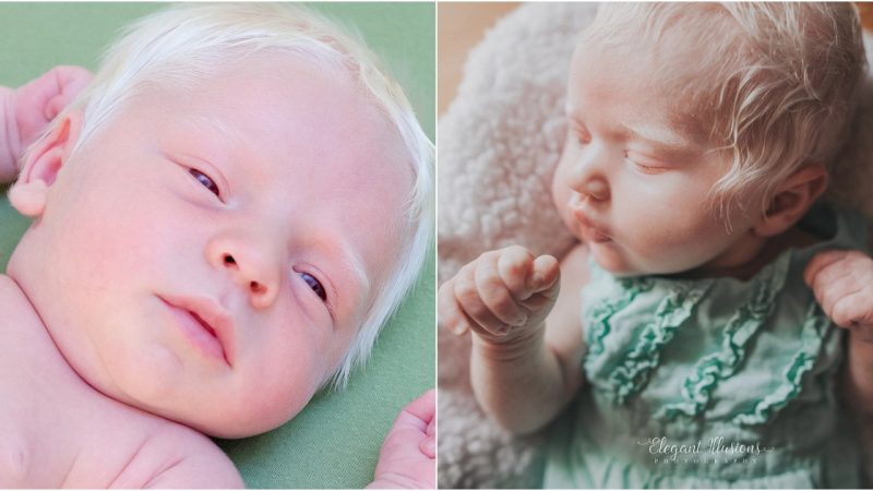 “Enchanting White-Haired Baby Boy Delights the World as ‘Prince Charming’”.