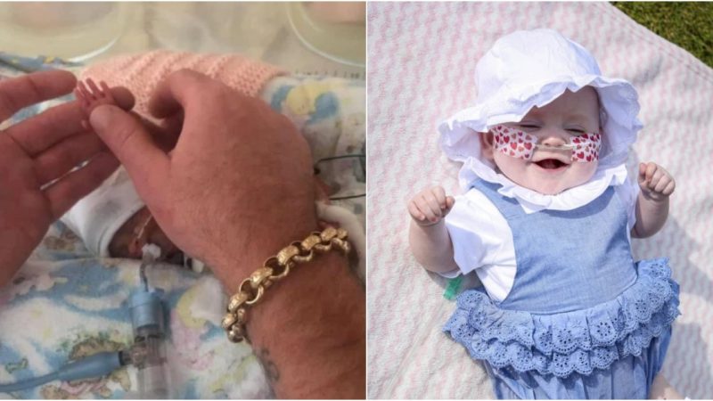 Miracle Baby: Tiny Newborn Born at 23 Weeks with Hands the Size of Her Dad’s Fingernail