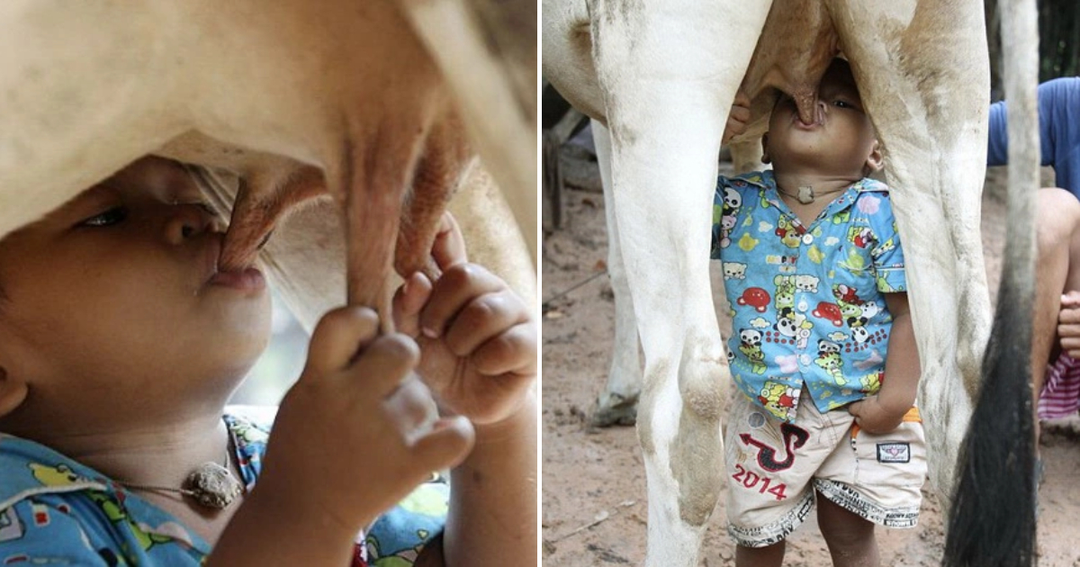 The Boy Survives by Nursing from a Cow