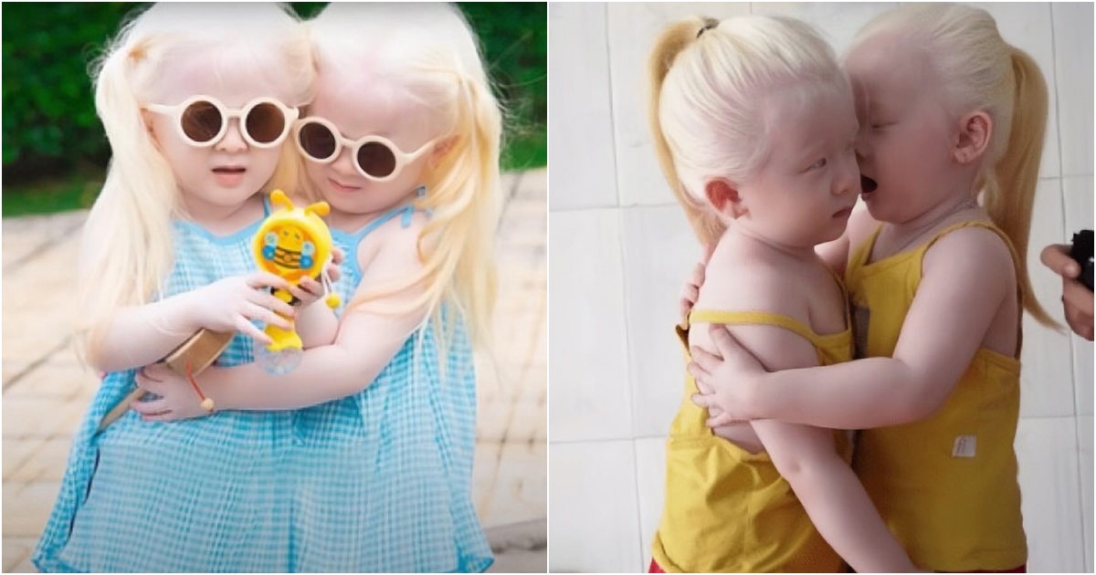 Mesmerizing Beauty Twin Babies Born with Snow-White Hair Capture Hearts with Their Unique Appearance!