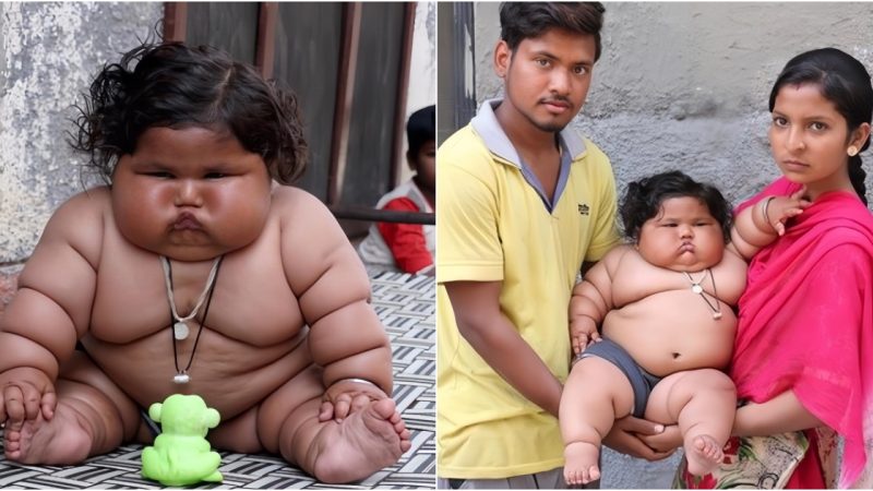 The Unfortunate Journey of the World’s Heaviest 1-Year-Old Girl