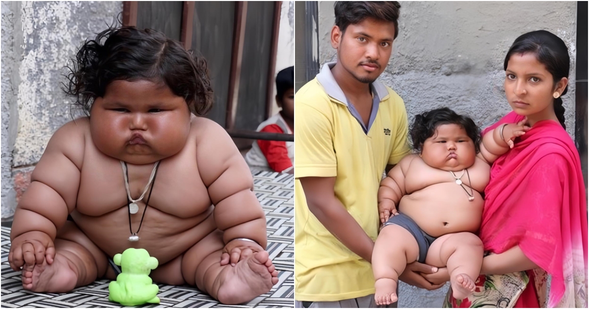 The Unfortunate Journey of the World’s Heaviest 1-Year-Old Girl