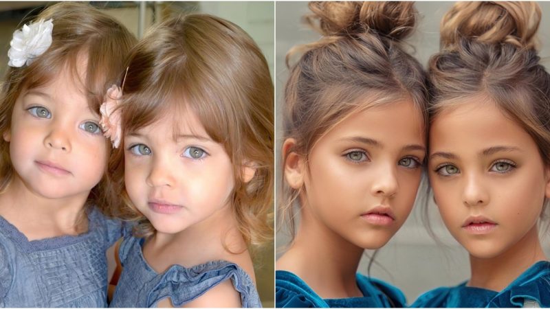 A Decade of Beauty The Evolution of the Twins Named ‘Most Beautiful in the World’