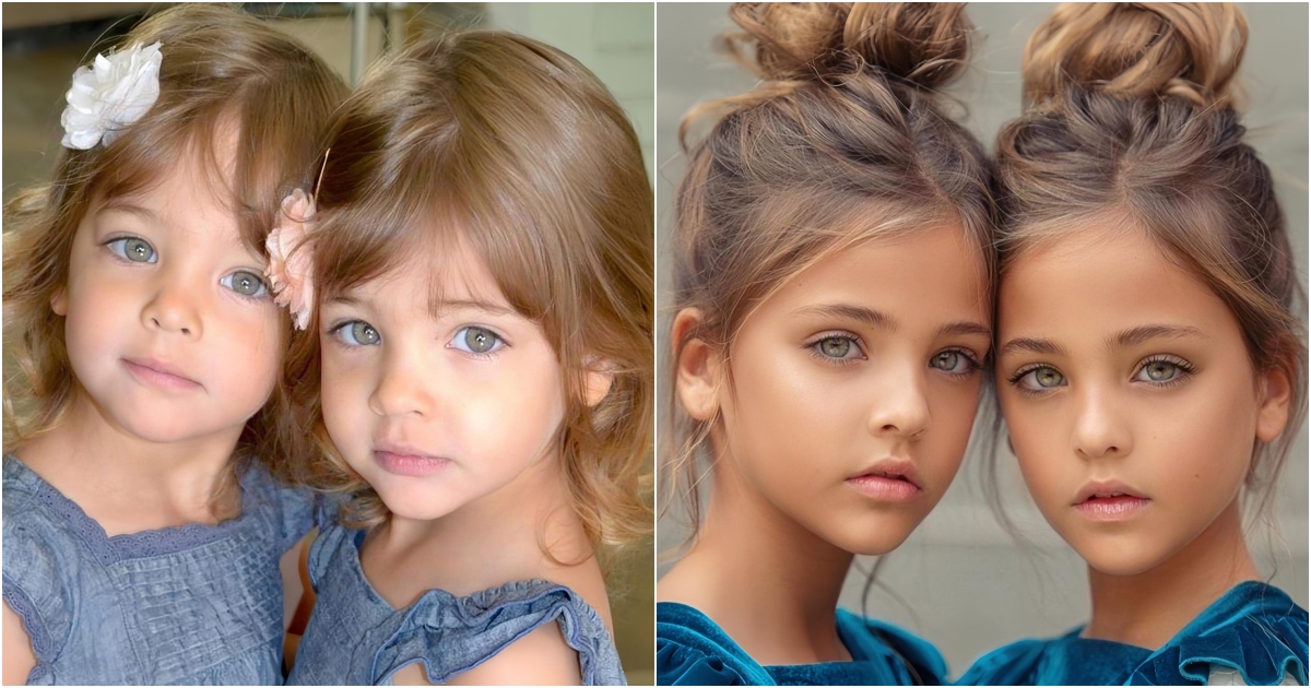 A Decade of Beauty The Evolution of the Twins Named ‘Most Beautiful in the World’