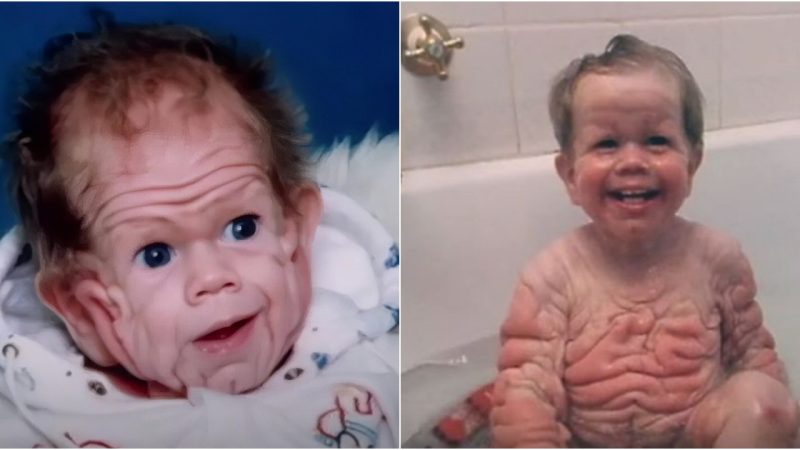 A Fascinating Tale The Baby Born with a Unique Skin Condition