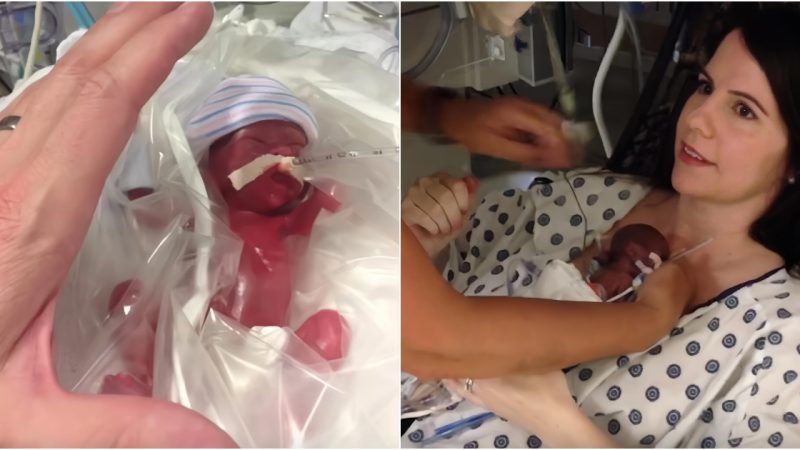 A Heartwarming First Encounter: Parents Embrace Their 15-Week Premature Baby