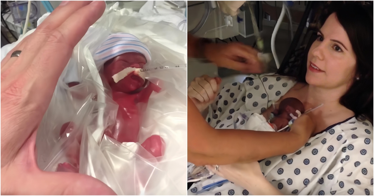 A Heartwarming First Encounter: Parents Embrace Their 15-Week Premature Baby