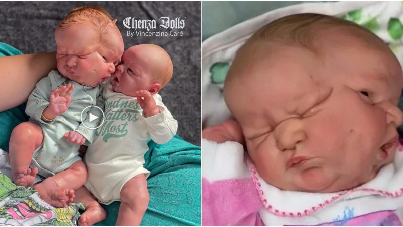 “Extraordinary newborn baby with remarkable conjoined faces captures online community with love and sympathy”