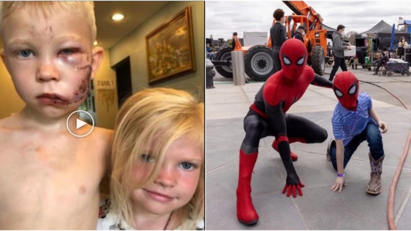 Incredible Act of Heroism ‘Spider-Man’ Brother Saves Sister from Savage Dog Attack, Inspiring Millions Worldwide