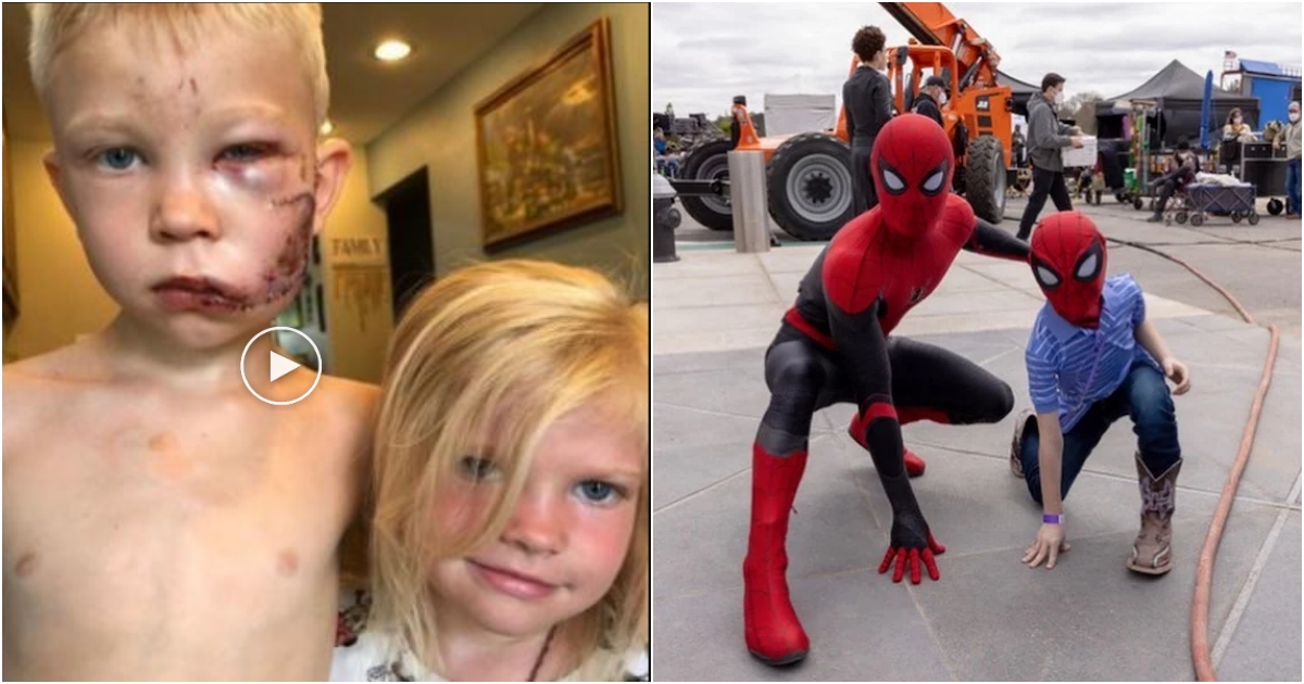 Incredible Act of Heroism ‘Spider-Man’ Brother Saves Sister from Savage Dog Attack, Inspiring Millions Worldwide