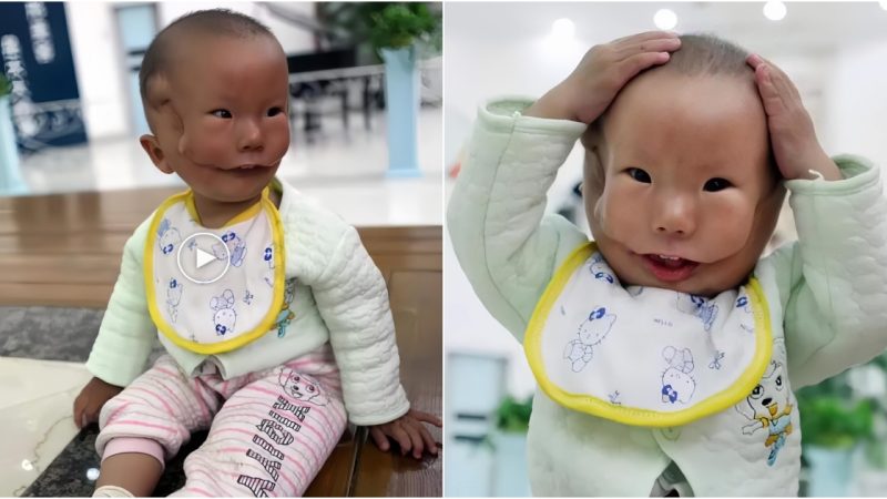 The whole family was shocked Mother was shocked when she saw that her daughter was born with 2 faces