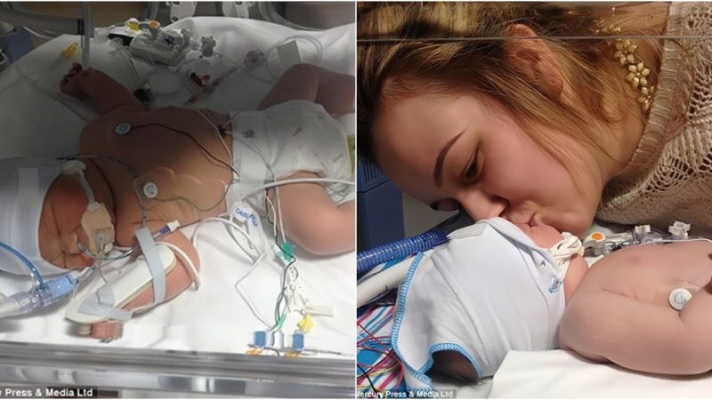 Miraculous Revival Newborn Baby Awakens After 26 Minutes of Not Breathing, Thanks to Mother’s Loving Kiss