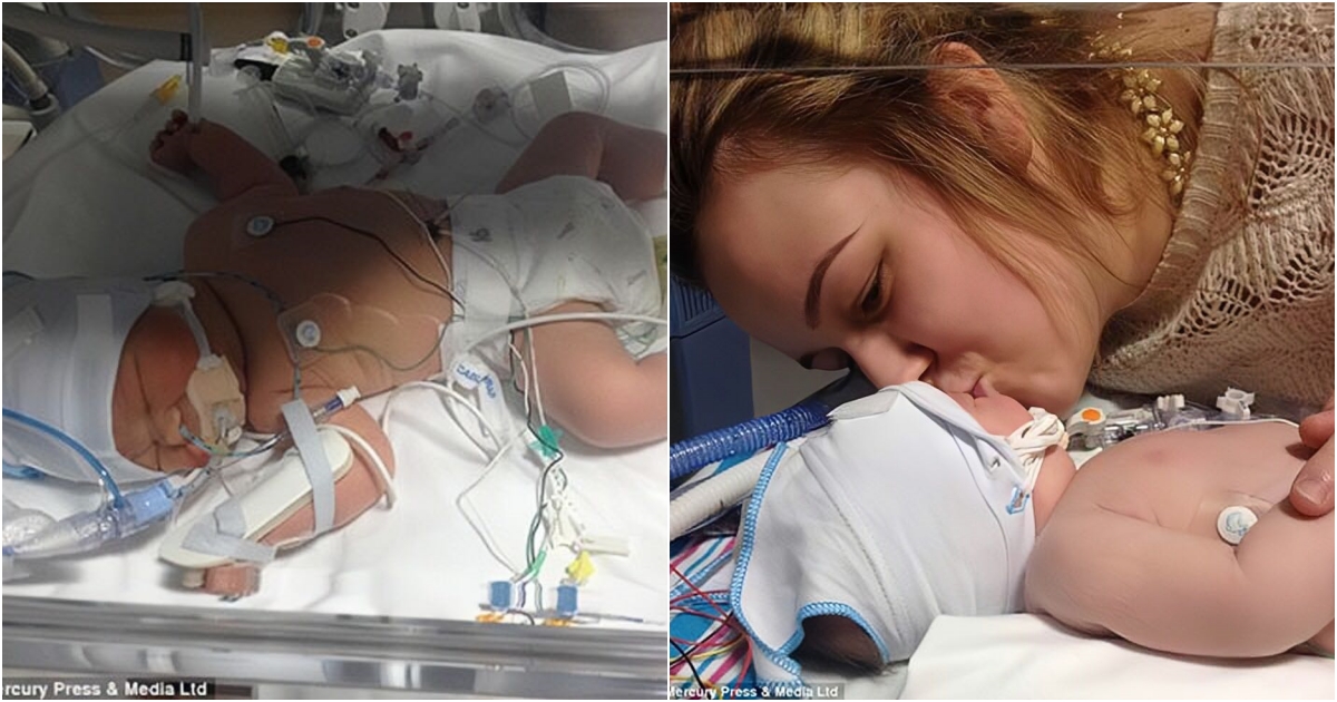 Miraculous Revival Newborn Baby Awakens After 26 Minutes of Not Breathing, Thanks to Mother’s Loving Kiss