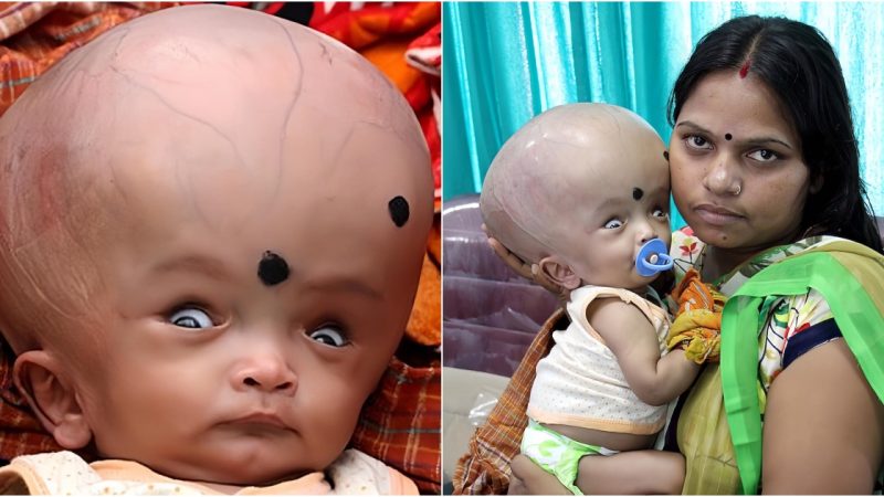 A 4-Month-Old Baby with a Head 3 Times Larger Than Normal Is Abandoned – Heart of the Community