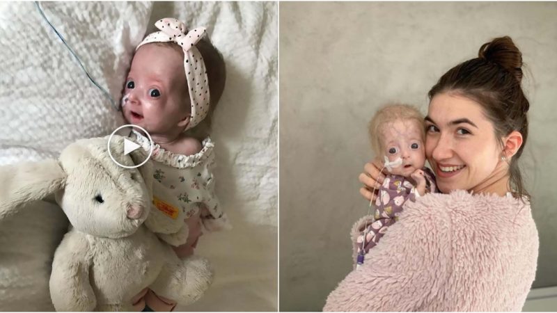 The Courageous Journey of Eline Léonie Defying Neonatal Progeria with a Radiant Smile!