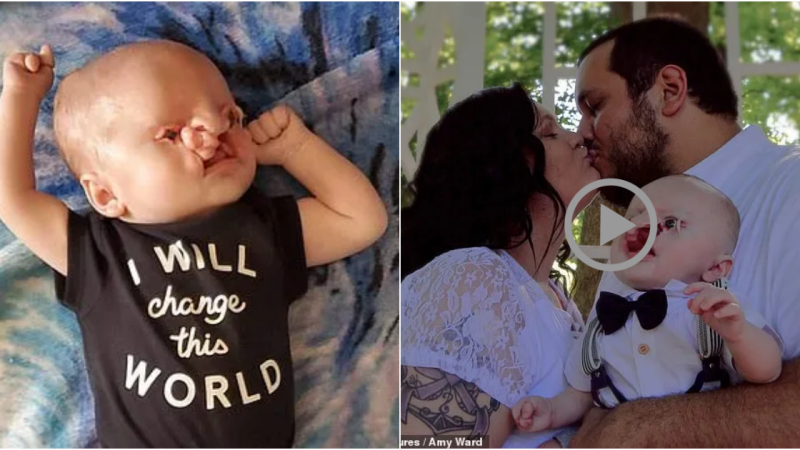 Boundless Love: Mother’s Courage in Raising a Child with Birth Defects Despite Cruel Online Trolls