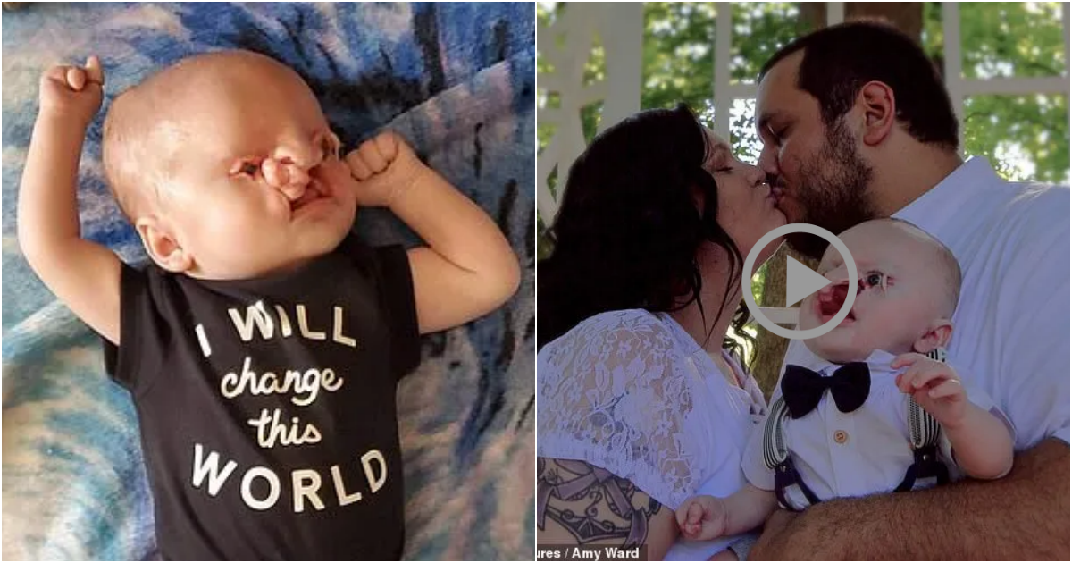 Boundless Love: Mother’s Courage in Raising a Child with Birth Defects Despite Cruel Online Trolls