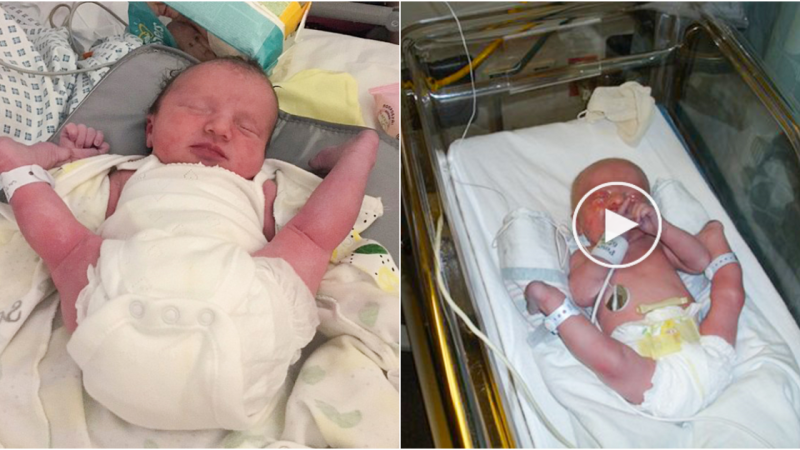 Little Gymnast’s Unusual Arrival: The Baby Born with ‘Chicken Legs’