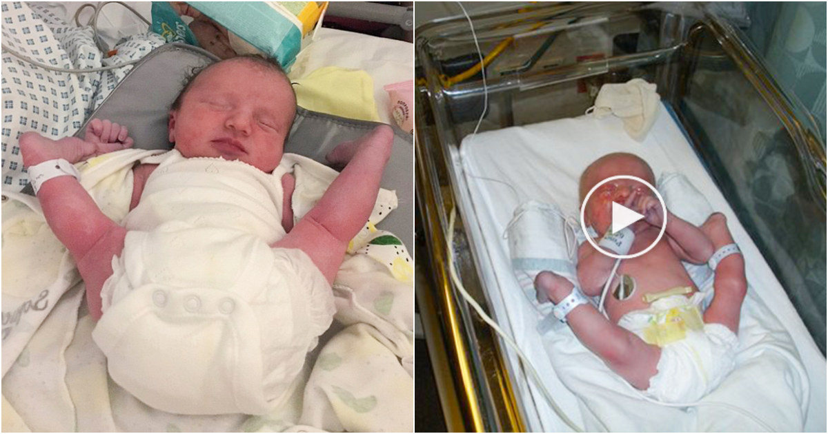 Little Gymnast’s Unusual Arrival: The Baby Born with ‘Chicken Legs’