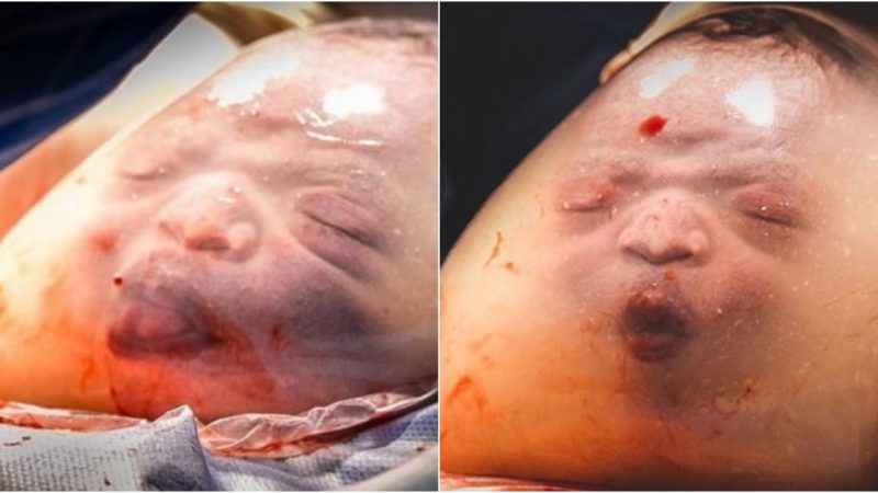 New Year’s Luck: Baby Born in Amniotic Sac with Adorable Expression Melts Everyone’s Hearts