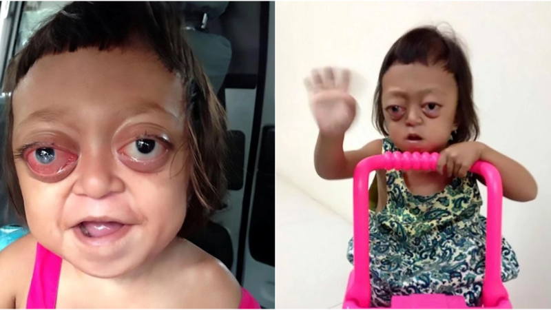 Anabelle’s Heartbreaking Journey: A Story of Hope and Resilience