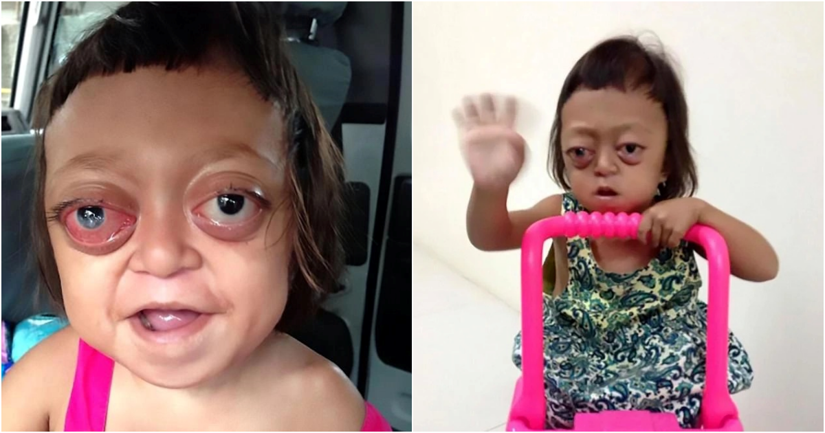 Anabelle’s Heartbreaking Journey: A Story of Hope and Resilience