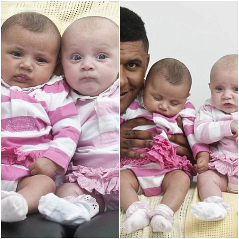 “Unveiling the Marvel of Diversity: The Remarkable Tale of Different-Skinned Twins”